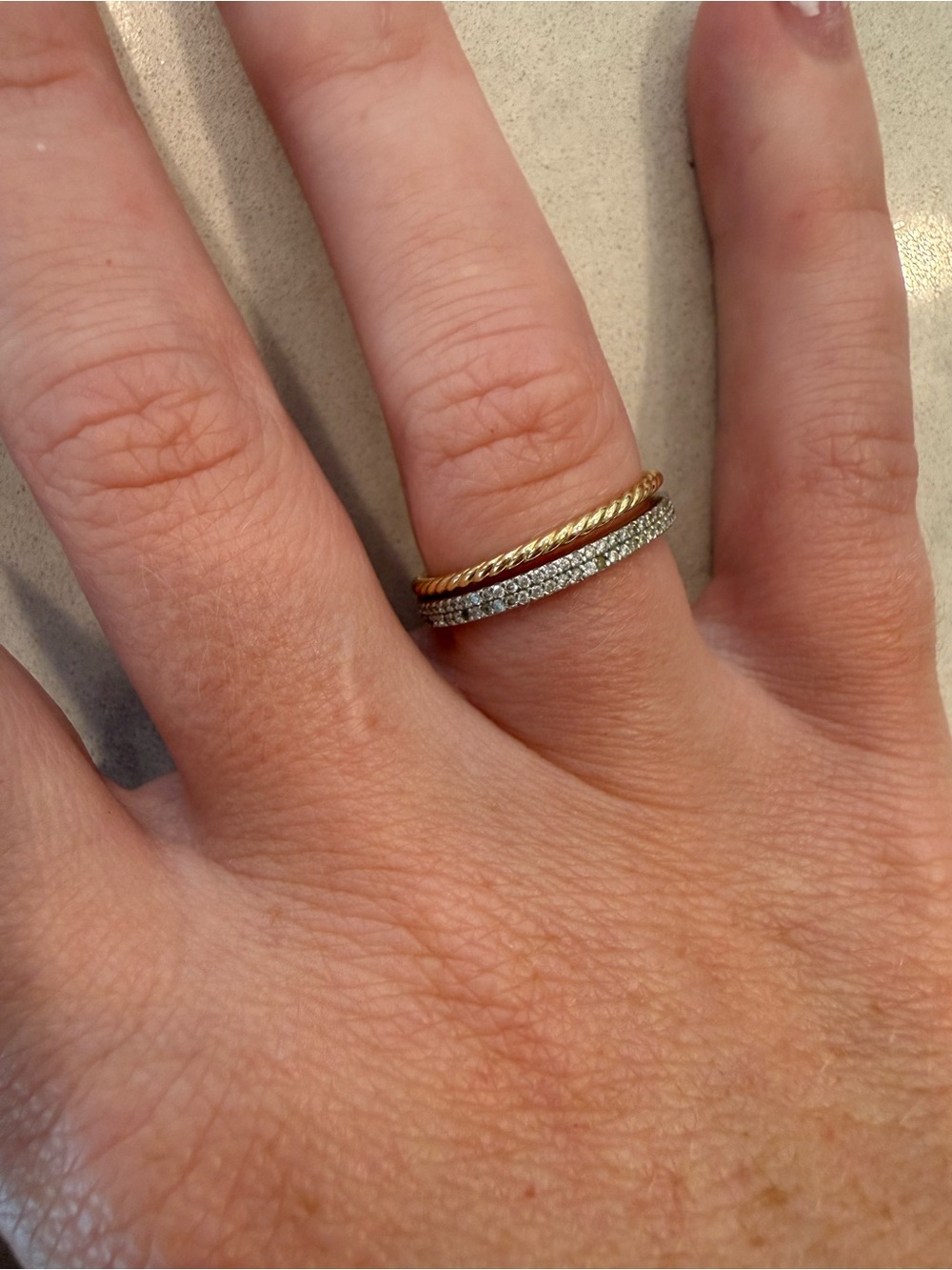 Ring Concierge Rings - Picture 3 of 5